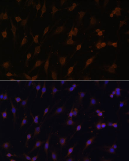 Immunofluorescence analysis of C6 cells using POR Polyclonal Antibody at dilution of  1:100 (40x lens). Blue: DAPI for nuclear staining.