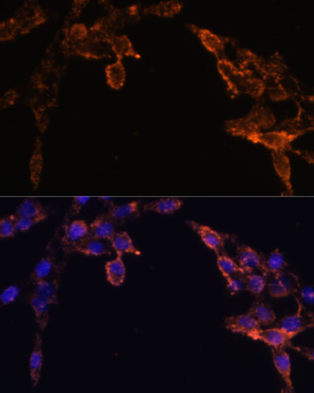 Immunofluorescence analysis of HeLa cells using POR Polyclonal Antibody at dilution of  1:100 (40x lens). Blue: DAPI for nuclear staining.