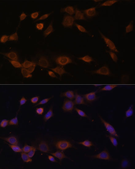 Immunofluorescence analysis of NIH-3T3 cells using POR Polyclonal Antibody at dilution of  1:100 (40x lens). Blue: DAPI for nuclear staining.