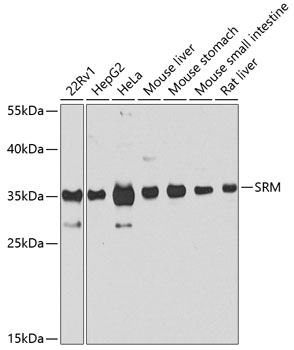 Western blot analysis of extracts of various cell lines using SRM Polyclonal Antibody at dilution of 1:1000.