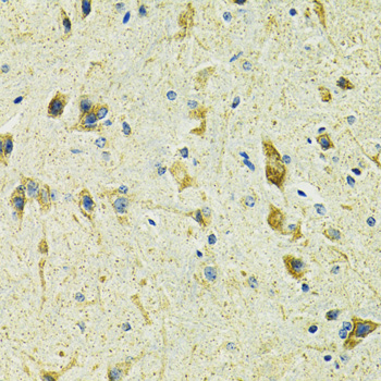 Immunohistochemistry of paraffin-embedded Mouse spinal cord using SLC25A11 Polyclonal Antibody at dilution of  1:100 (40x lens).