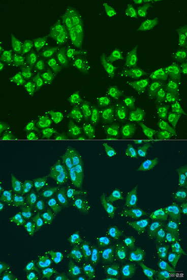 Immunofluorescence analysis of U2OS cells using THOC1 Polyclonal Antibody at dilution of  1:100. Blue: DAPI for nuclear staining.