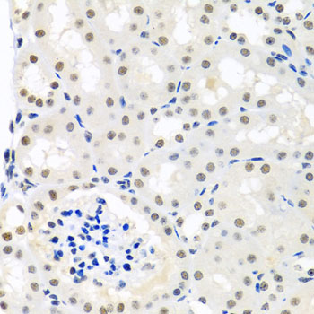 Immunohistochemistry of paraffin-embedded Mouse kidney using THOC1 Polyclonal Antibody at dilution of  1:100 (40x lens).
