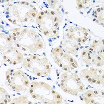 Immunohistochemistry of paraffin-embedded Human stomach using THOC1 Polyclonal Antibody at dilution of  1:100 (40x lens).
