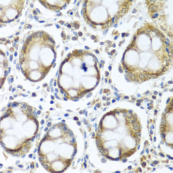 Immunohistochemistry of paraffin-embedded Human colon using IFI44 Polyclonal Antibody at dilution of  1:100 (40x lens).