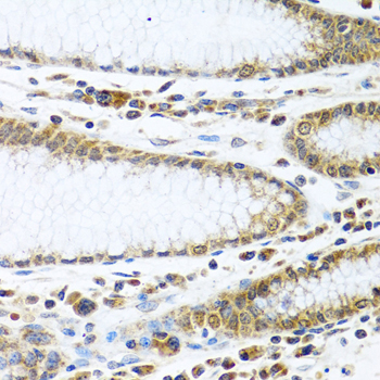 Immunohistochemistry of paraffin-embedded Human stomach using IFI44 Polyclonal Antibody at dilution of  1:100 (40x lens).