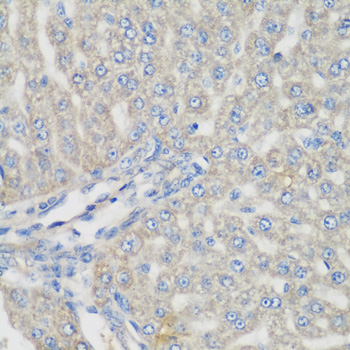 Immunohistochemistry of paraffin-embedded Rat liver using METTL7A Polyclonal Antibody at dilution of  1:200 (40x lens).