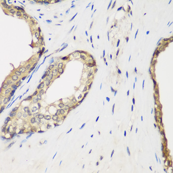Immunohistochemistry of paraffin-embedded Human prostate using METTL7A Polyclonal Antibody at dilution of  1:200 (40x lens).