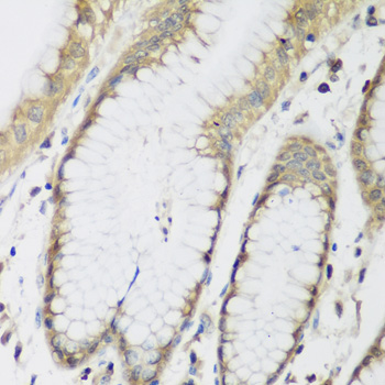 Immunohistochemistry of paraffin-embedded Human stomach using METTL7A Polyclonal Antibody at dilution of  1:200 (40x lens).