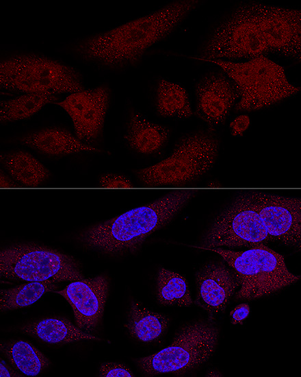 Confocal immunofluorescence analysis of U2OS cells using TAZ Polyclonal Antibody at dilution of  1:100 (60x lens). Blue: DAPI for nuclear staining.