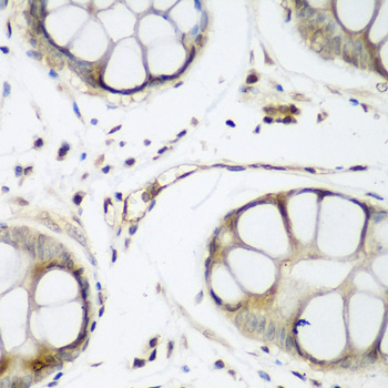 Immunohistochemistry of paraffin-embedded Human gastric using TAZ Polyclonal Antibody at dilution of  1:200 (40x lens).