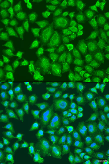 Immunofluorescence analysis of U2OS cells using PARL Polyclonal Antibody at dilution of  1:100. Blue: DAPI for nuclear staining.