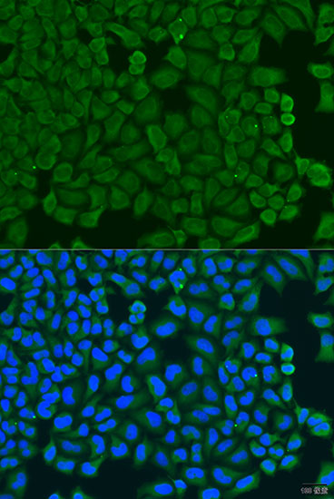 Immunofluorescence analysis of U2OS cells using KCTD15 Polyclonal Antibody at dilution of  1:100. Blue: DAPI for nuclear staining.