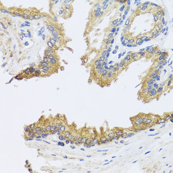 Immunohistochemistry of paraffin-embedded Human prostate using ARL6 Polyclonal Antibody at dilution of  1:100 (40x lens).