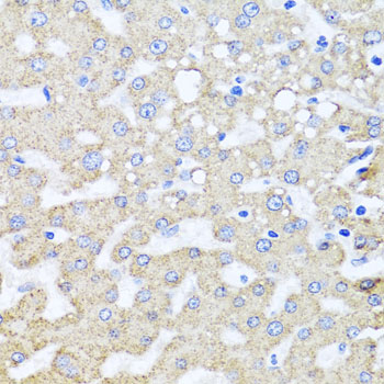 Immunohistochemistry of paraffin-embedded Human liver damage using ARL6 Polyclonal Antibody at dilution of  1:100 (40x lens).