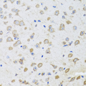 Immunohistochemistry of paraffin-embedded Mouse brain using ARL6 Polyclonal Antibody at dilution of  1:100 (40x lens).