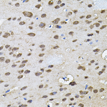 Immunohistochemistry of paraffin-embedded Rat brain using RNF166 Polyclonal Antibody