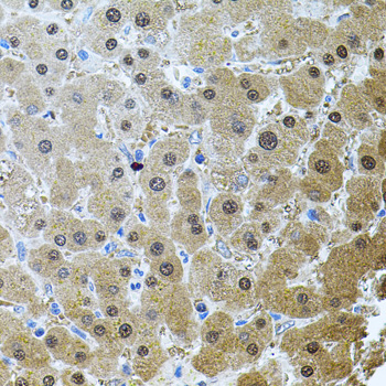 Immunohistochemistry of paraffin-embedded Human liver damage using RNF166 Polyclonal Antibody