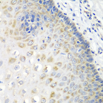 Immunohistochemistry of paraffin-embedded Human esophagus using STXBP4 Polyclonal Antibody at dilution of  1:100 (40x lens).