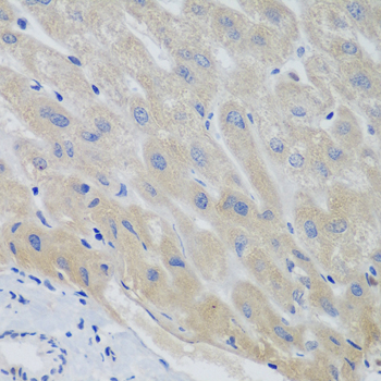 Immunohistochemistry of paraffin-embedded Human liver using PTTG1 Polyclonal Antibody at dilution of  1:100 (40x lens).