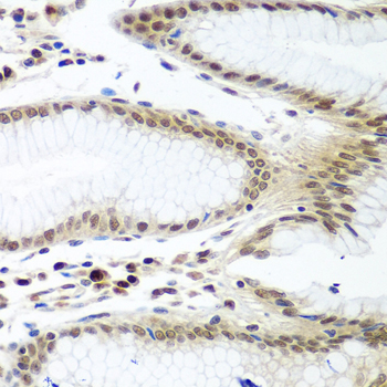 Immunohistochemistry of paraffin-embedded Human stomach using PTTG1 Polyclonal Antibody at dilution of  1:100 (40x lens).