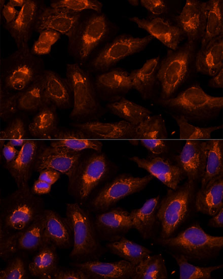 Immunofluorescence analysis of U-2 OS cells using BFAR Polyclonal Antibody at dilution of  1:100 (40x lens). Blue: DAPI for nuclear staining.