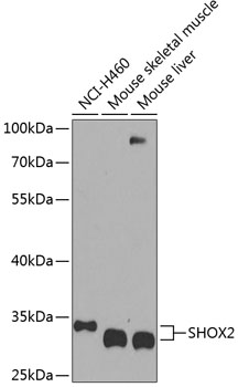 Western blot analysis of extracts of various cell lines using SHOX2 Polyclonal Antibody at dilution of 1:1000.