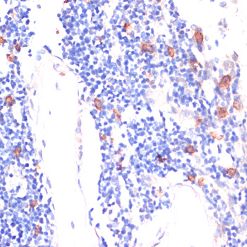 Immunohistochemistry of paraffin-embedded Rat bone marrow using WNT5B Polyclonal Antibody at dilution of  1:100 (40x lens).