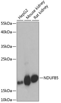 Western blot analysis of extracts of various cell lines using NDUFB5 Polyclonal Antibody at dilution of 1:1000.