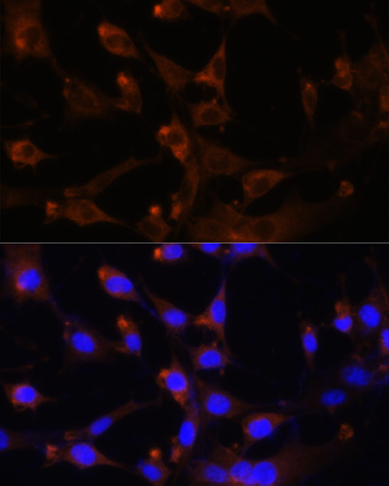 Immunofluorescence analysis of NIH-3T3 cells using CAD Polyclonal Antibody at dilution of  1:100. Blue: DAPI for nuclear staining.