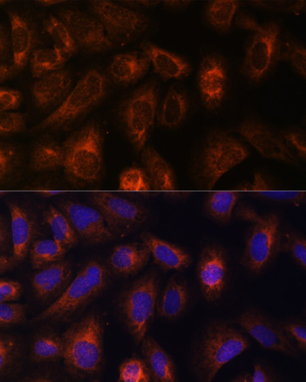 Immunofluorescence analysis of U-2 OS cells using CAD Polyclonal Antibody at dilution of  1:100. Blue: DAPI for nuclear staining.