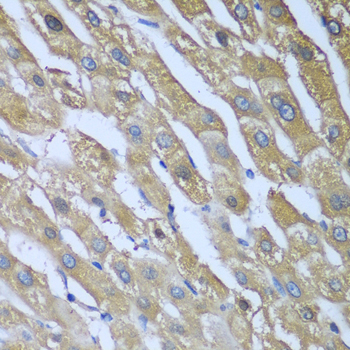 Immunohistochemistry of paraffin-embedded Human liver using CAD Polyclonal Antibody at dilution of  1:100 (40x lens).