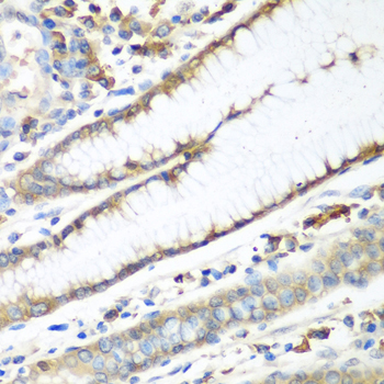 Immunohistochemistry of paraffin-embedded Human stomach using CAD Polyclonal Antibody at dilution of  1:100 (40x lens).