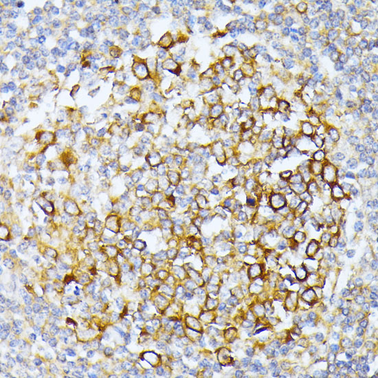 Immunohistochemistry of paraffin-embedded Human tonsil using CAD Polyclonal Antibody at dilution of  1:100 (40x lens).