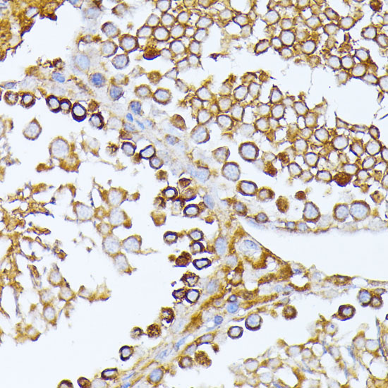Immunohistochemistry of paraffin-embedded Rat testis using CAD Polyclonal Antibody at dilution of  1:100 (40x lens).