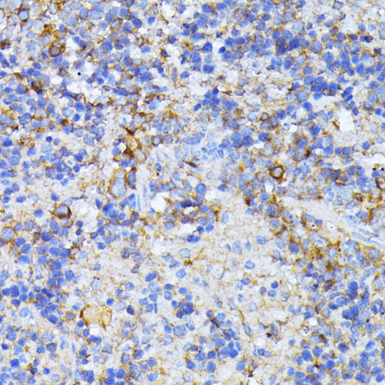 Immunohistochemistry of paraffin-embedded Mouse spleen using CAD Polyclonal Antibody at dilution of  1:100 (40x lens).