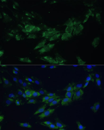 Immunofluorescence analysis of C6 cells using EPHA4 Polyclonal Antibody at dilution of  1:100. Blue: DAPI for nuclear staining.