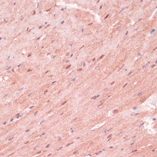 Immunohistochemistry of paraffin-embedded Mouse heart using RNF5 Polyclonal Antibody at dilution of  1:100 (40x lens).