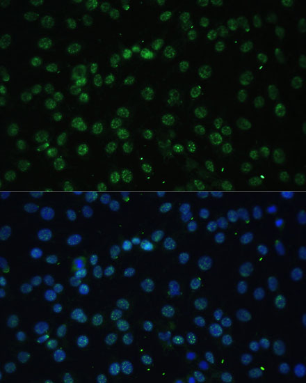 Immunofluorescence analysis of C6 cells using DDX39B Polyclonal Antibody at dilution of  1:100 (40x lens). Blue: DAPI for nuclear staining.