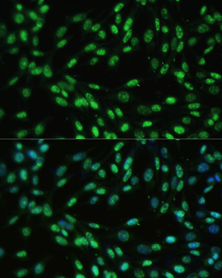 Immunofluorescence analysis of NIH-3T3 cells using DDX39B Polyclonal Antibody at dilution of  1:100 (40x lens). Blue: DAPI for nuclear staining.