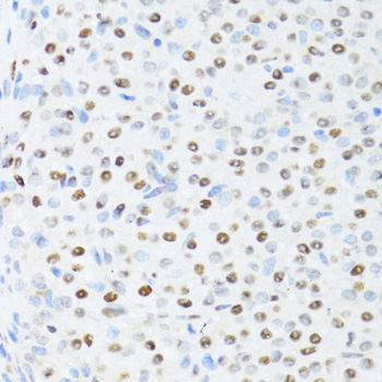 Immunohistochemistry of paraffin-embedded Rat ovary using DDX39B Polyclonal Antibody at dilution of  1:100 (40x lens).