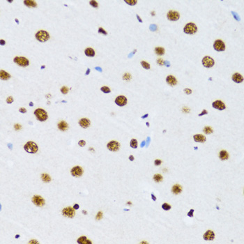 Immunohistochemistry of paraffin-embedded Rat brain using DDX39B Polyclonal Antibody at dilution of  1:100 (40x lens).