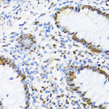 Immunohistochemistry of paraffin-embedded Human appendix using DDX39B Polyclonal Antibody at dilution of  1:100 (40x lens).