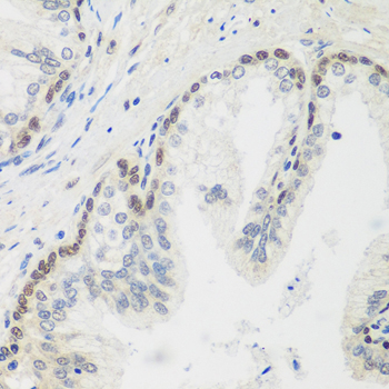 Immunohistochemistry of paraffin-embedded Human prostate using MDC1 Polyclonal Antibody at dilution of  1:100 (40x lens).