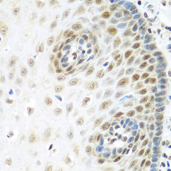 Immunohistochemistry of paraffin-embedded Human esophagus using MDC1 Polyclonal Antibody at dilution of  1:100 (40x lens).