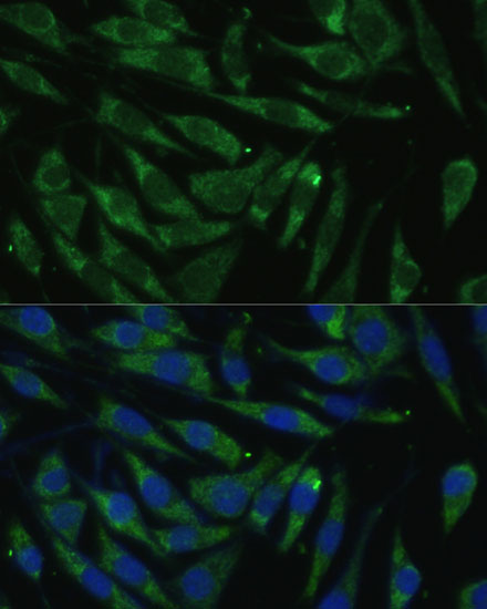 Immunofluorescence analysis of L929 cells using PITRM1 Polyclonal Antibody at dilution of  1:100 (40x lens). Blue: DAPI for nuclear staining.