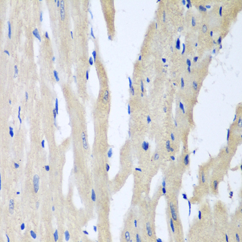 Immunohistochemistry of paraffin-embedded Rat heart using PITRM1 Polyclonal Antibody at dilution of  1:100 (40x lens).