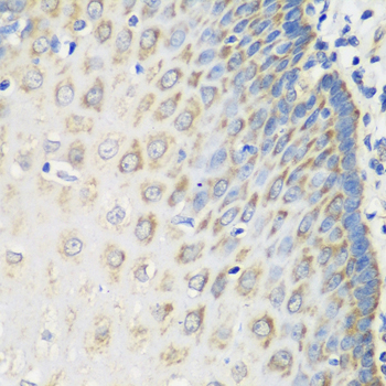 Immunohistochemistry of paraffin-embedded Human esophagus using MSRB2 Polyclonal Antibody at dilution of  1:100 (40x lens).