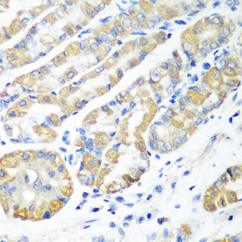 Immunohistochemistry of paraffin-embedded Human stomach using MSRB2 Polyclonal Antibody at dilution of  1:100 (40x lens).