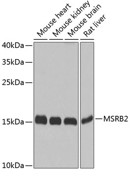 Western blot analysis of extracts of various cell lines using MSRB2 Polyclonal Antibody at dilution of 1:1000.